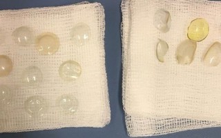 怎么拿掉隐形眼镜，怎么拿掉隐形眼镜视频