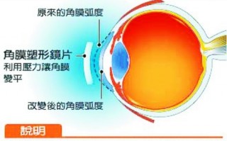 戴塑形镜有气泡怎么办，戴塑形镜的危害